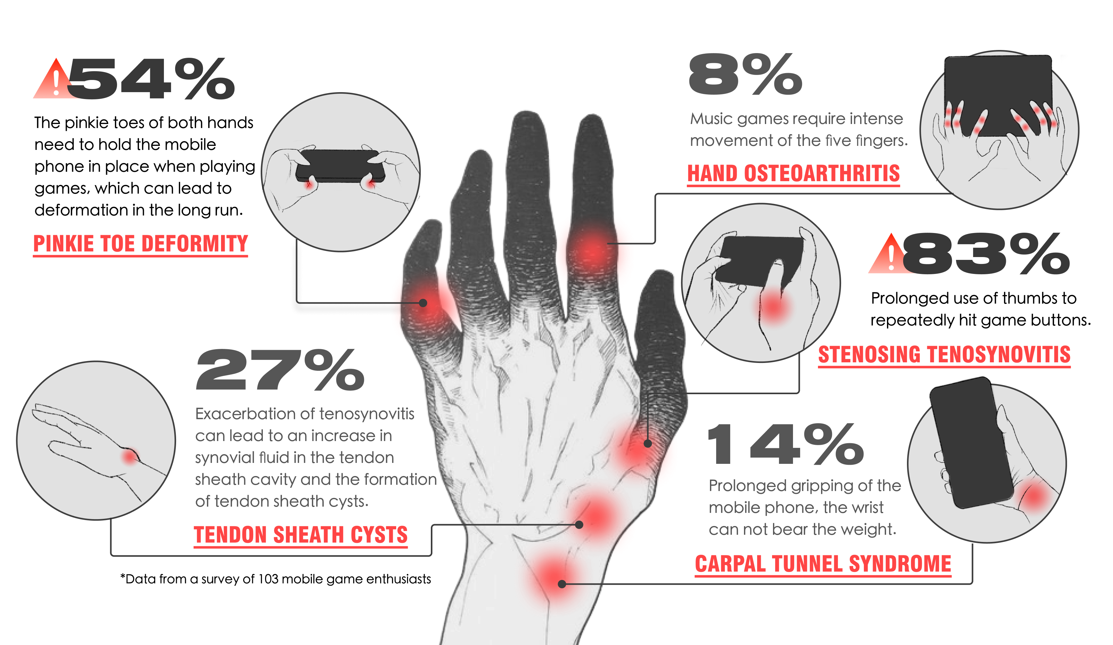 Hand diseases related to playing mobile games